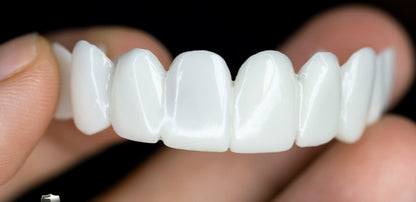 Turbo Cables – Snap On Teeth Veneers with Custom Fit for Natural Smile